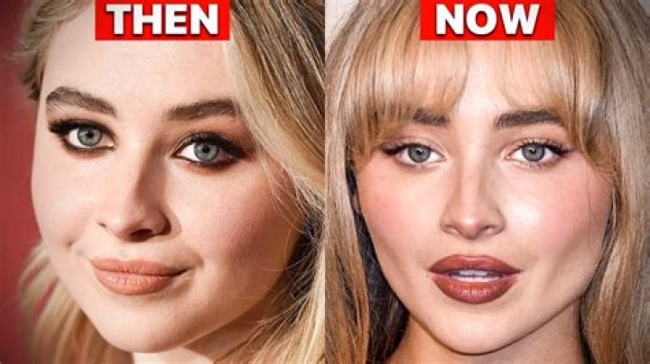 Sabrina Carpenter's Lip Injections: The Transformation Journey