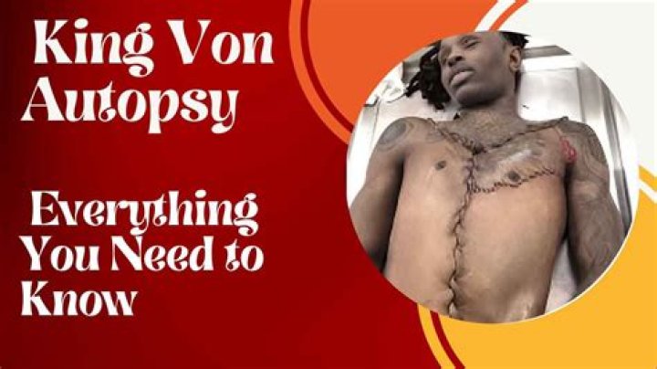 The Leaked Autopsy Of King Von: Uncovering The Truth