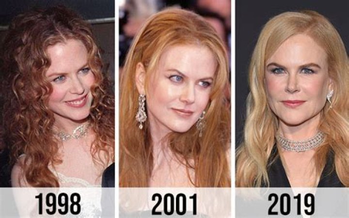 The Surprising Evolution Of Nicole Kidman's Look: Botox Or Natural Beauty?