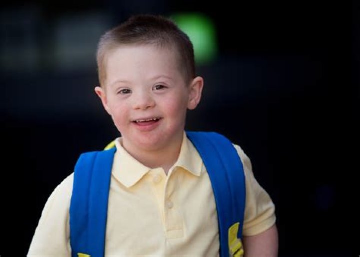 The Truth About George Clooney's Down's Syndrome Child