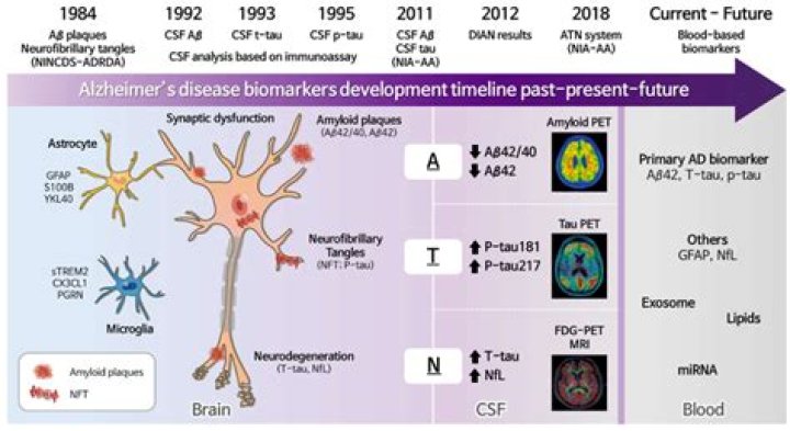 Unraveling The Complexities Of Alzheimer And The Importance Of Early Diagnosis