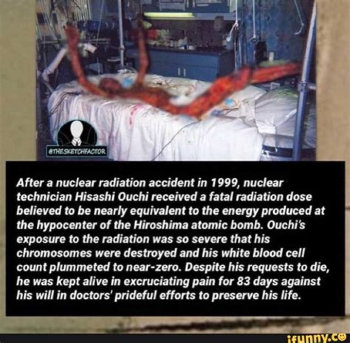 Unraveling The Hisashi Nuclear Accident: A Reflection On Safety And Responsibility