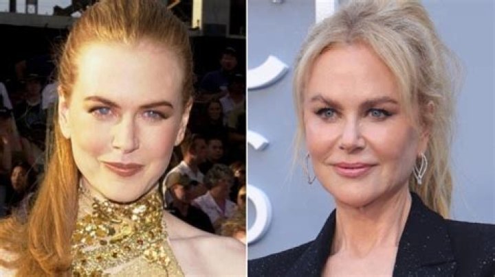 Unveiling Nicole Kidman's Radiant Transformation: A 2024 Facelift