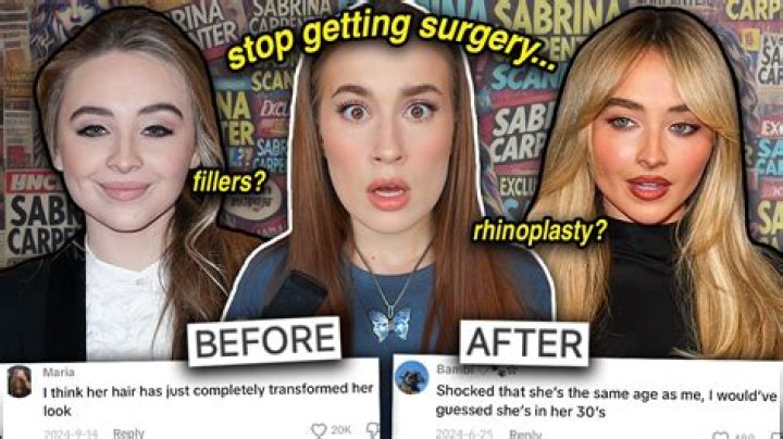 Unveiling The Truth: Has Sabrina Carpenter Had A Nose Job?