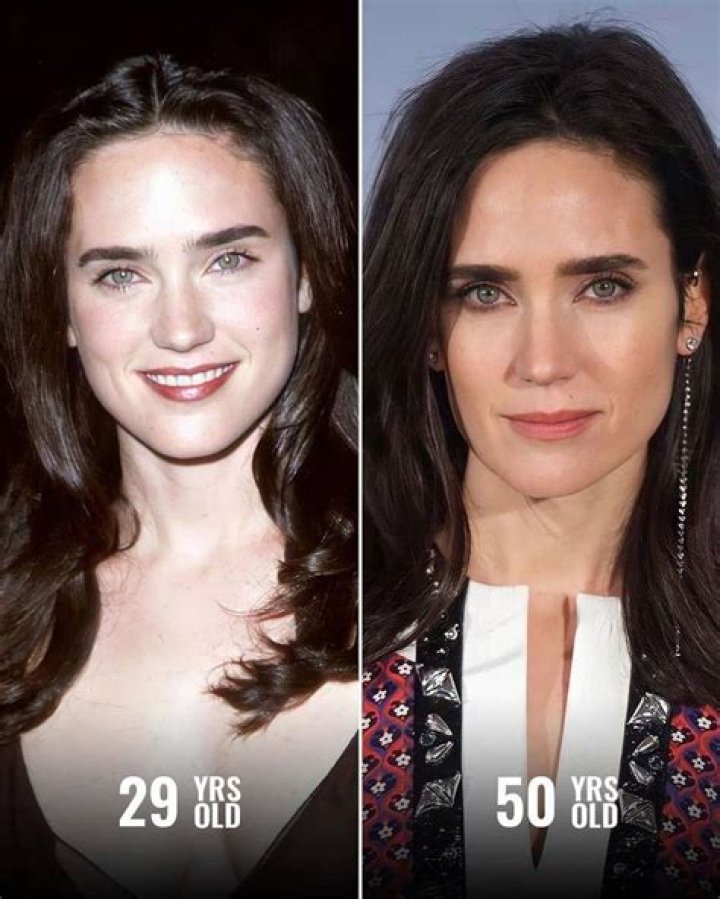 Unveiling The Truth: Jennifer Connelly's Plastic Surgery Journey